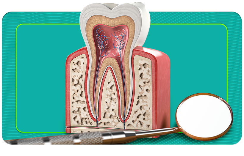 Root-canal Treatment