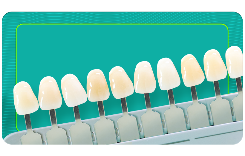 Metal-Containing Porcelain Structures Are Abandoned Every Day in Orthodontics